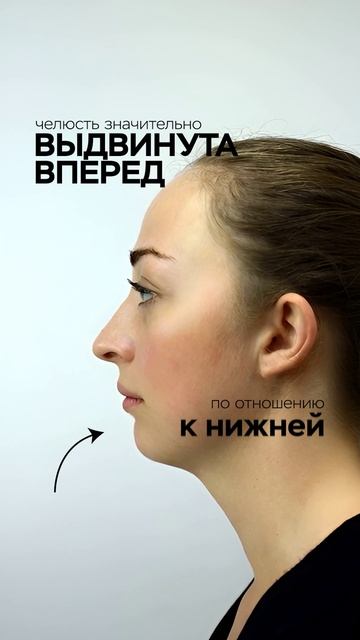 3 вида самых опасных прикусов