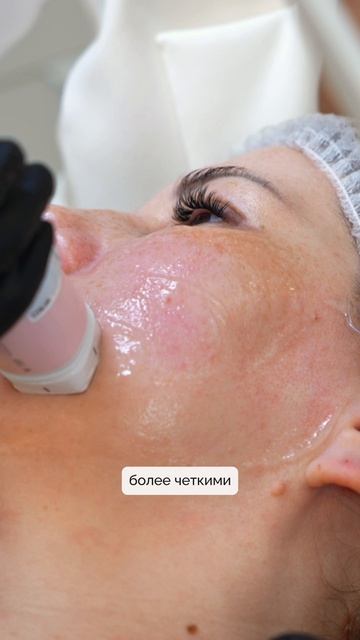 Свежий вид без инъекций и лишнего объёма — возможно ли это?