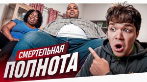 ЧЕЛОВЕК КИТ - СМЕРТЕЛЬНАЯ ПОЛНОТА