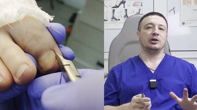 Кусачки для вросшего ногтя мастера Зайцева МК4 смотреть онлайн