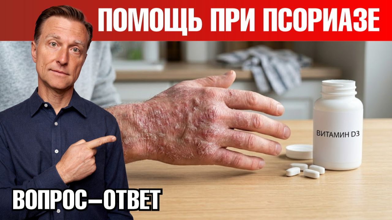 ЭТО поможет при псориазе смотреть онлайн