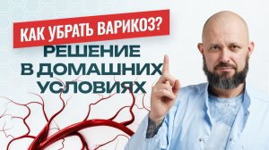 Как убрать варикоз самостоятельно?