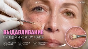 САМЫЕ ЖЕСТКИЕ ПРЫЩИ И ЧЕРНЫЕ ТОЧКИ | БОЛЕЕ ЧАСА БЕЗ ОСТАНОВКИ