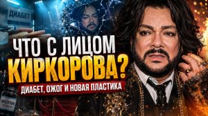 Что на самом деле случилось с лицом Киркорова? Как диабет, ожог и новая пластика разрушили его жизнь