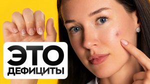 Дефицит витаминов — 9 способов узнать об этом БЕЗ врача