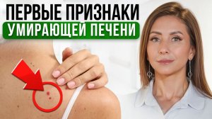 10 признаков, что ПЕЧЕНЬ БОЛЬНА! Как проверить здоровье печени?