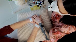 Professional Skin Analysis & Allergy Test On Both Arms ASMR