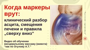 Когда маркеры врут: клинический разбор асцита, смещения печени и правила „сверху вниз”.