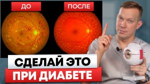 Если у вас есть диабет — посмотрите это видео! – 3 работающих метода, которые спасают от слепоты