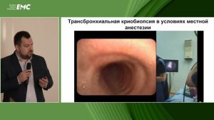 5. Маменко И.С. Трансбронхиальные методы биопсии в диагностике микобактерий - от смыва до крио
