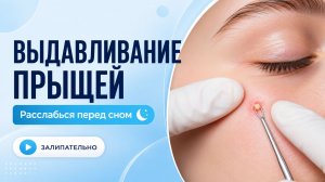ВЫДАВЛИВАНИЕ ПРЫЩЕЙ И ОЧИЩЕНИЕ КОЖЫ ОТ ЧЕРНЫХ ТОЧЕК (4)