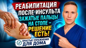 Реабилитация после инсульта. Зажатые пальцы на стопе парализованной  ноги. Что делать, как исправить