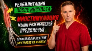 Восстановление после инсульта. Миостимуляция разгибателей предплечья. Наложение электродов.