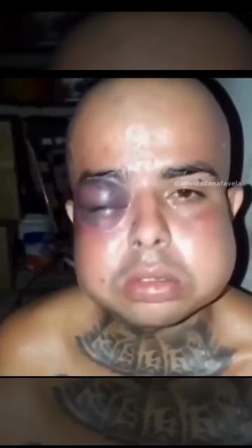 Пчелы покусали наверное🌚 смотреть онлайн