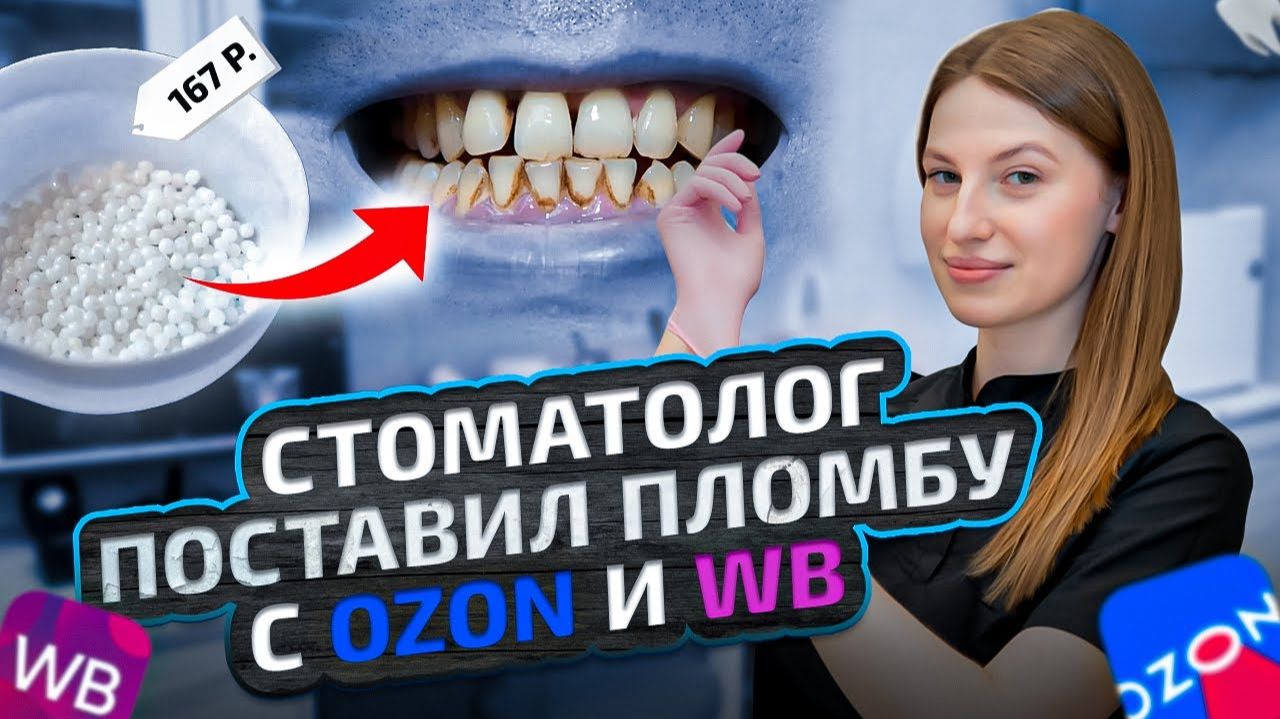 Стоматолог поставил себе пломбу за 167 рублей с WB и OZON