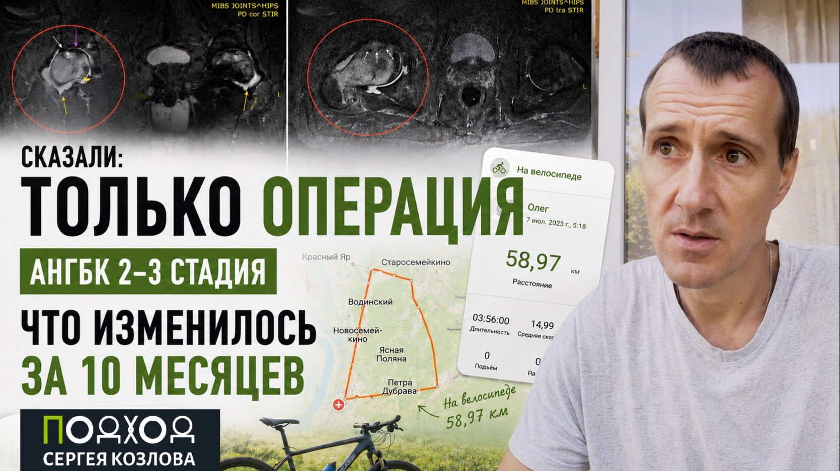 АНГБК 2-3 стадии: я не сделал операцию | Через 10 месяцев я снова хожу на своих суставах