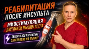 Реабилитация после инсульта. Миостимуляция бицепса плеча. Правильное наложение электродов.