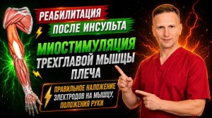 Миостимуляция трехглавой мышцы плеча. Правильное наложение электродов миостимулятора.