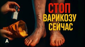 6 привычек, что калечат сосуды