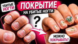 На ЭТИ ногти нельзя делать покрытие? 😱