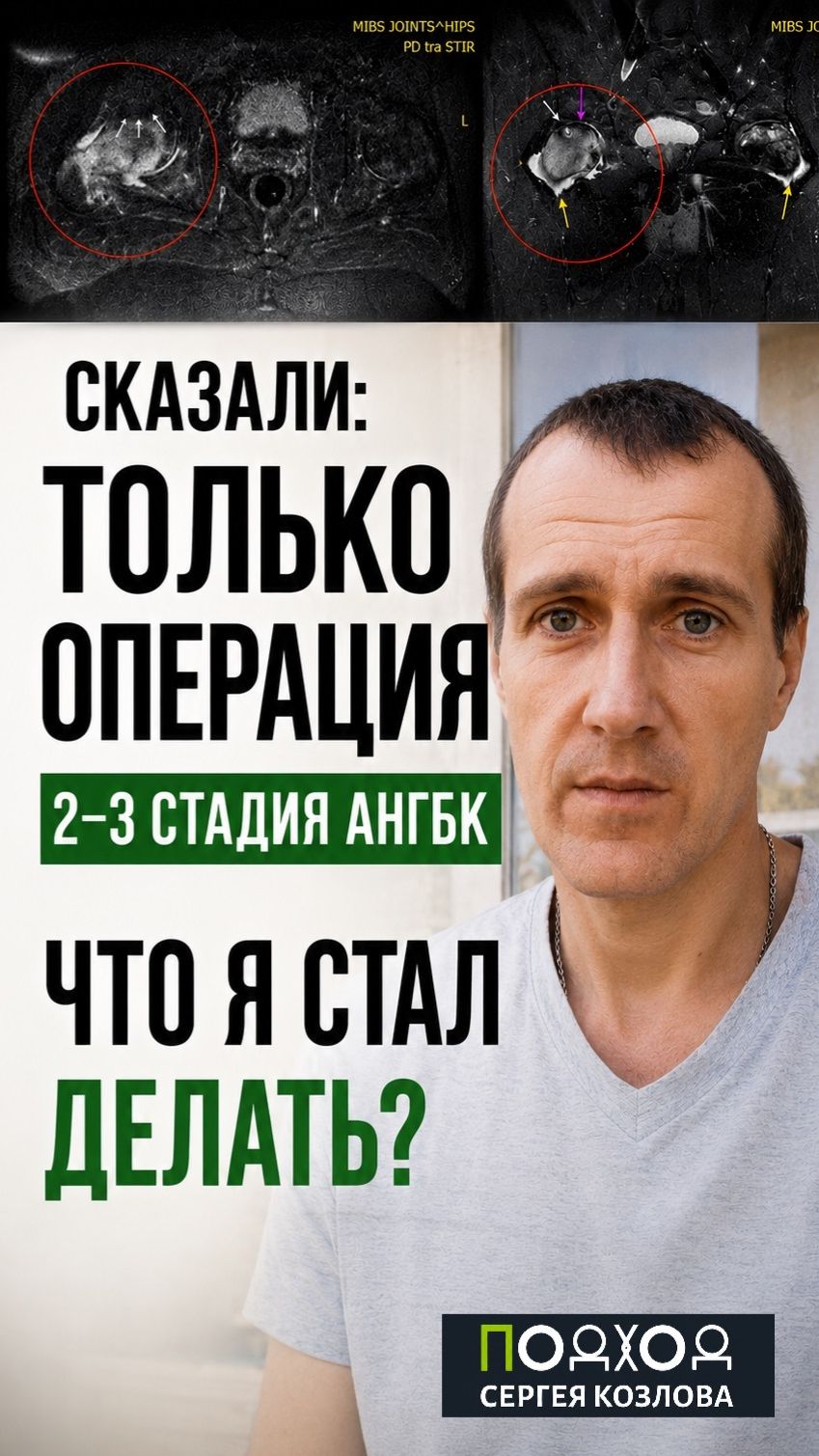 Только операция? Что я сделал при АНГБК 2-3 стадии?