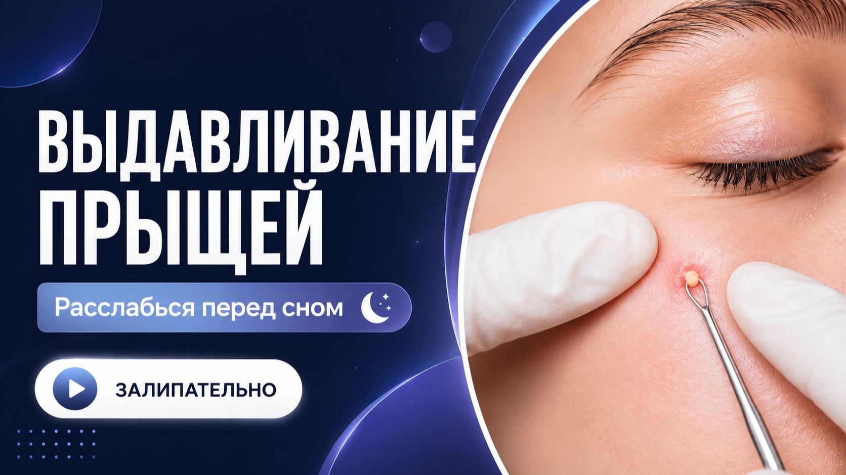 ВЫДАВЛИВАНИЕ ПРЫЩЕЙ И ОЧИЩЕНИЕ КОЖЫ ОТ ЧЕРНЫХ ТОЧЕК (5)