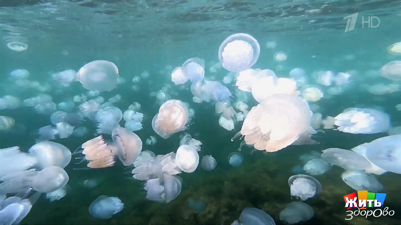 Осторожно, медузы: где водятся и как действовать при ожоге. Жить здорово! Фрагмент выпуска от 15....