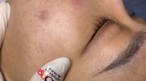 210 • Acne collection • АСМР • Relax Spa