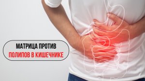 🛡️ МАТРИЦА «ПРОТИВ ПОЛИПОВ В КИШЕЧНИКЕ» — Волновая Генетика ✨
