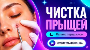 ВЫДАВЛИВАНИЕ ПРЫЩЕЙ И ОЧИЩЕНИЕ КОЖЫ ОТ ЧЕРНЫХ ТОЧЕК (17)