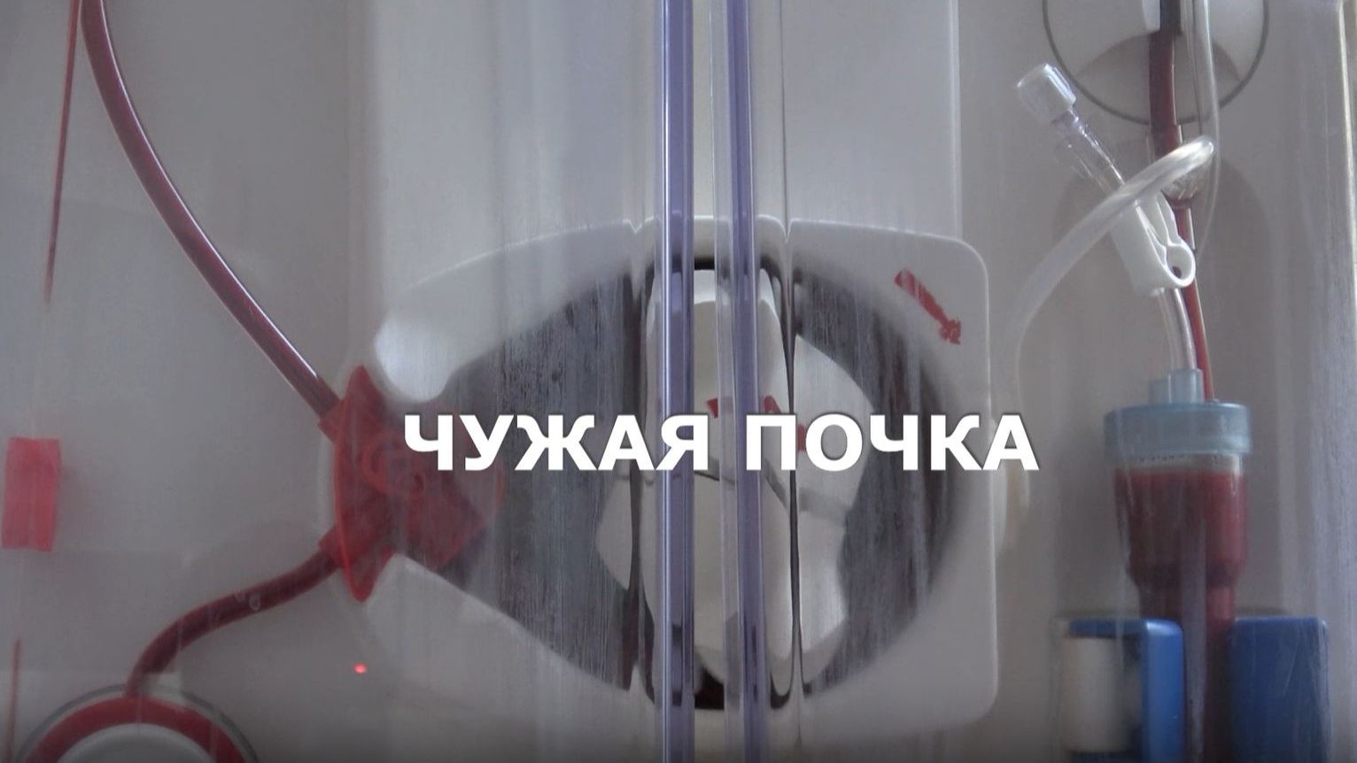 Чужая почка | Специальный репортаж Ольги Бондаревой