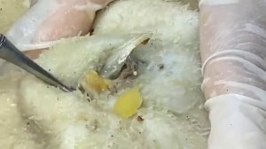 ВЫДАВЛИВАЕТ ПРЫЩИ И УГРИ. СОЧНОЕ РЕЛАКС ВИДЕО