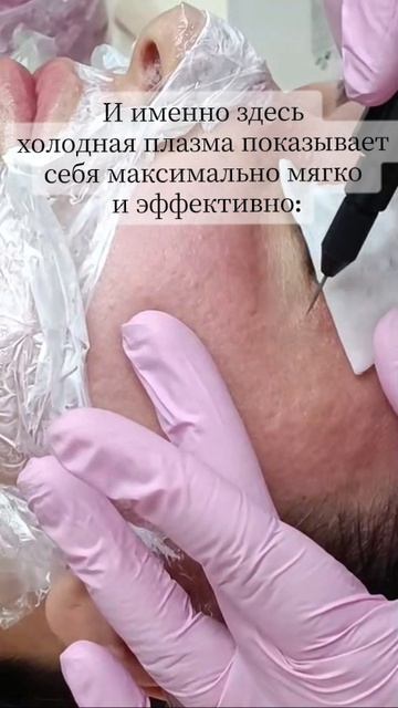 Периорбитальная зона одна из самых сложных и чувствительных!