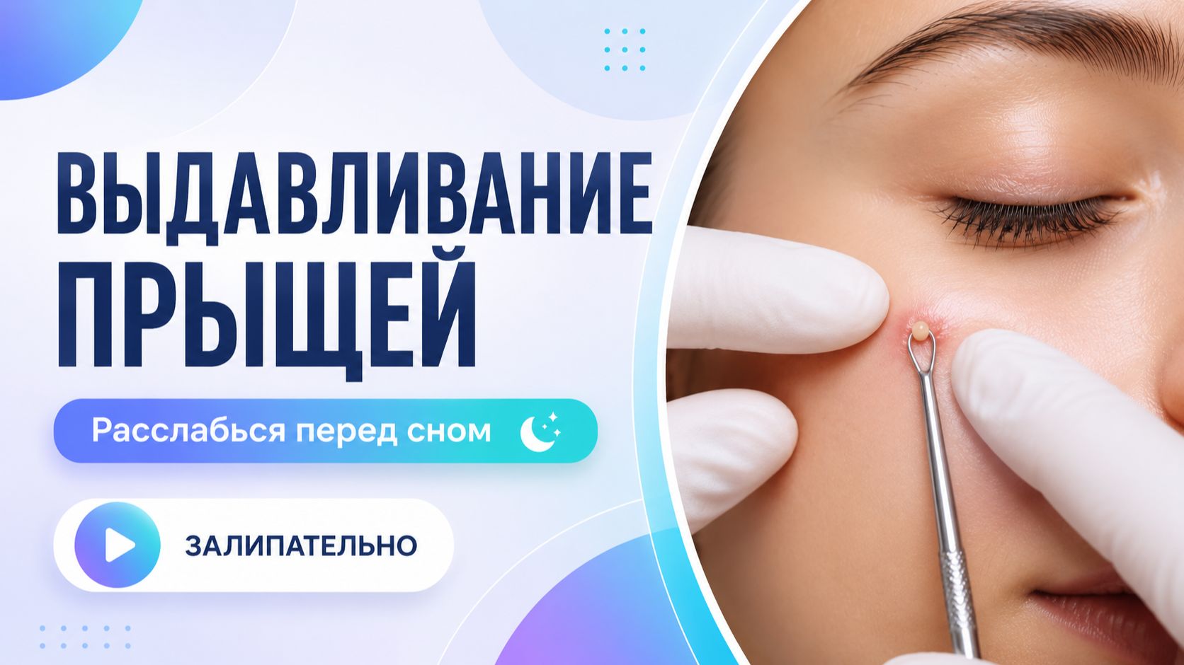 ВЫДАВЛИВАНИЕ ПРЫЩЕЙ И ОЧИЩЕНИЕ КОЖЫ ОТ ЧЕРНЫХ ТОЧЕК (15)