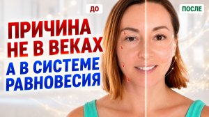 ЗАПАВШИЕ ГЛАЗА И НАВИСШИЕ ВЕКИ: связь, о которой почти никто не говорит