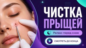 ВЫДАВЛИВАНИЕ ПРЫЩЕЙ И ОЧИЩЕНИЕ КОЖЫ ОТ ЧЕРНЫХ ТОЧЕК (16)