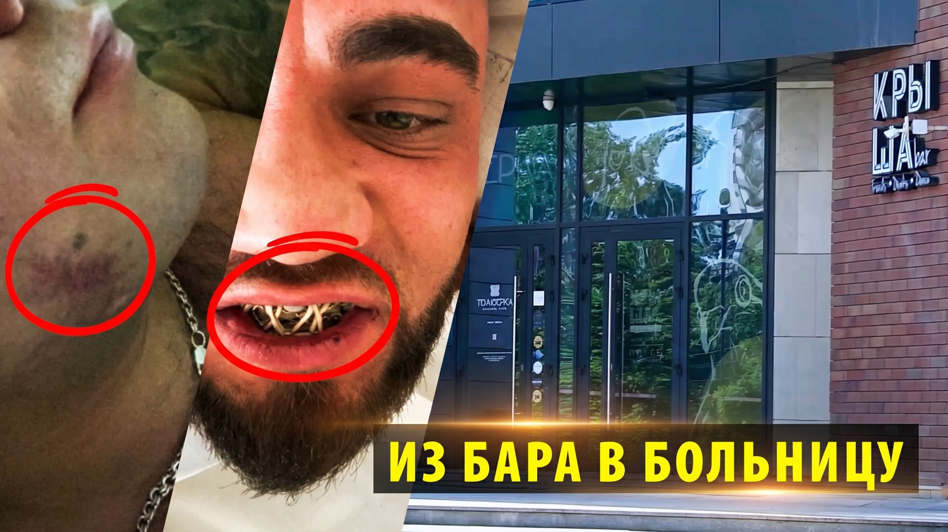 Новосибирец требует найти избивших его в баре Крыша агрессоров