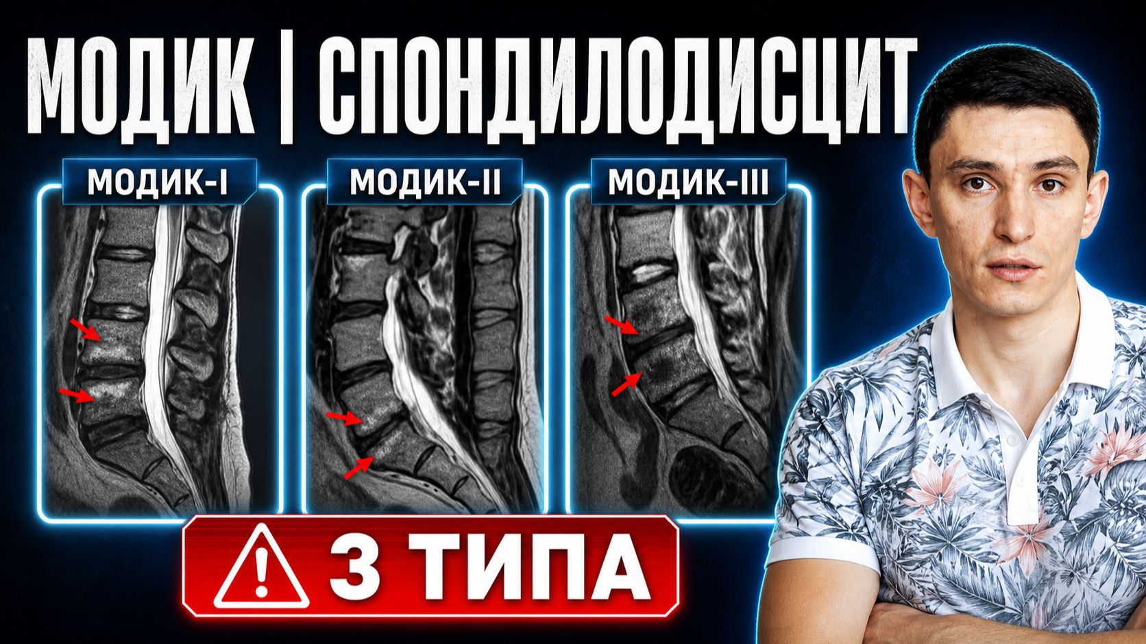 Модик. Спондилодисцит. Симптомы, последствия и лечение.
