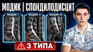 Модик. Спондилодисцит. Симптомы, последствия и лечение.