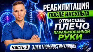Реабилитация после инсульта. Отвисшее плечо. Миостимуляция. Часть 3.
