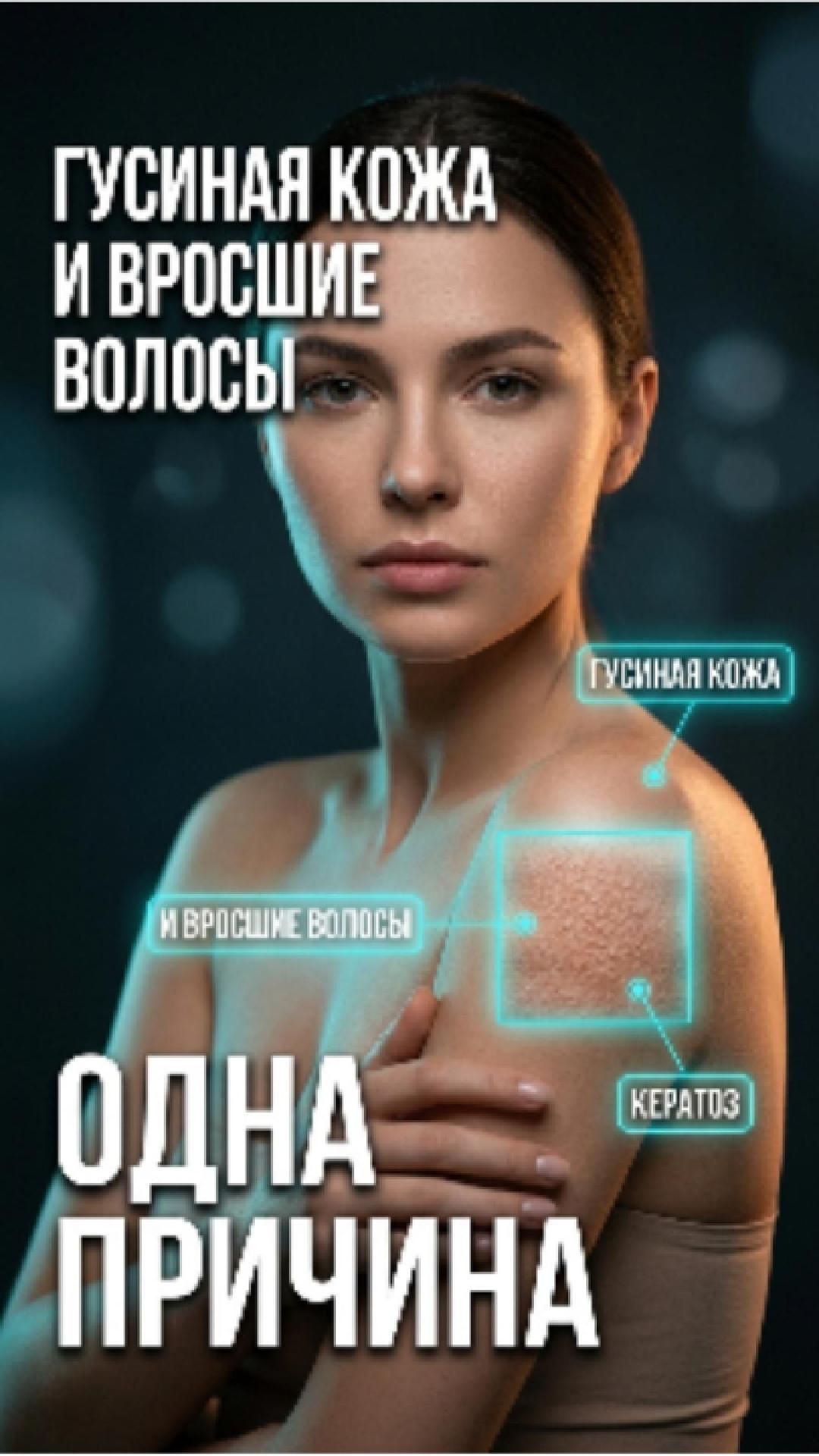 Гусиная кожа: кислоты помогут, но не от растяжек и жира. Когда нужна хирургия?