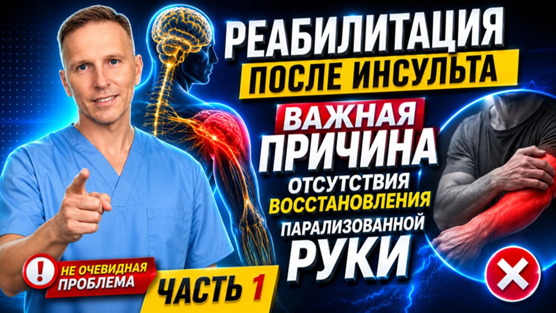 Реабилитация после инсульта. Одна из причин остановки прогресса в восстановлении. Пути решения. смотреть онлайн