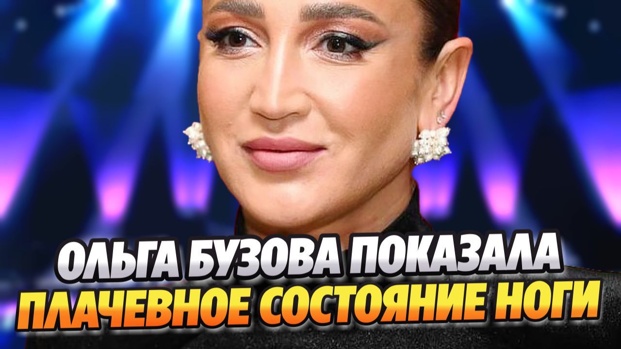 Ольга Бузова в слезах показала плачевное состояние ноги ★ Новости Шоу-Бизнеса смотреть онлайн