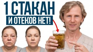 Минус 2 кг без диет! / ЛУЧШЕЕ ДОМАШНЕЕ средство от отеков!