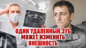 Один удаленный зуб может изменить внешность!