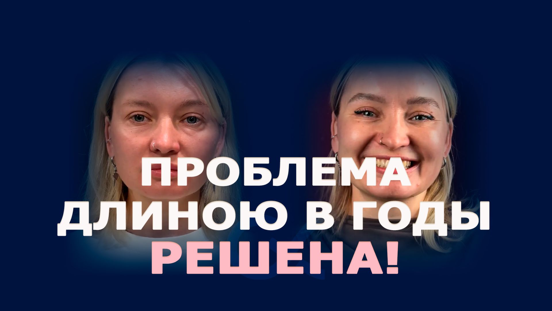 От усталого взгляда к свежему отражению: нижняя блефаропластика