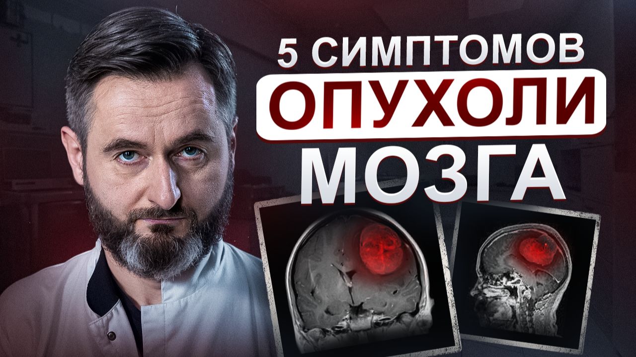 Опухоль мозга: почему головная боль — это не первый симптом? смотреть онлайн