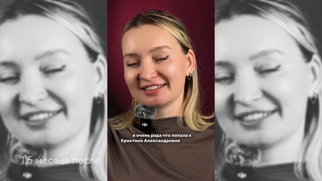 От усталого взгляда к свежему отражению: нижняя блефаропластика