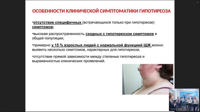 Щитовидная железа. Основные функции и возрастные особенности смотреть онлайн