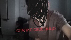 Спалил свое ЛИЦО!!!